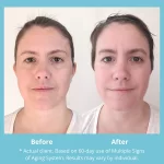 سرم ضدلک شفاف کننده و از بین برنده جای جوش دارک اسپات مناسب انواع پوست اکسیس وای 50 میل - Image 10