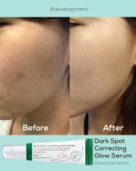 سرم ضدلک شفاف کننده و از بین برنده جای جوش دارک اسپات مناسب انواع پوست اکسیس وای 50 میل - Image 3