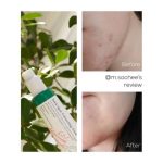سرم ضدلک شفاف کننده و از بین برنده جای جوش دارک اسپات مناسب انواع پوست اکسیس وای 50 میل - Image 2