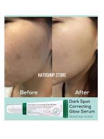 سرم ضدلک شفاف کننده و از بین برنده جای جوش دارک اسپات مناسب انواع پوست اکسیس وای 50 میل - Image 16