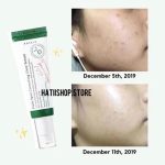 سرم ضدلک شفاف کننده و از بین برنده جای جوش دارک اسپات مناسب انواع پوست اکسیس وای 50 میل - Image 15